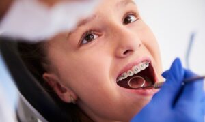 Common Orthodontic Issues in Children | Jack N Jill Dental Care