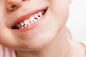 The Importance of Baby Teeth: Why Early Dental Care Matters